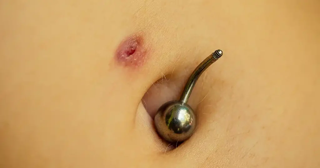 piercing wildfleisch was tun